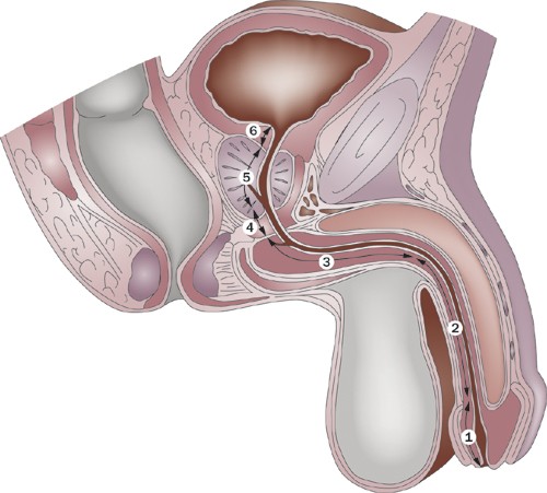 Urethral Stricture Treatment